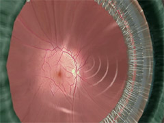 Click here for a 3-D panorama of the eye.