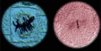 iKnow - Phases of Mitosis in Plant and Animal Cells