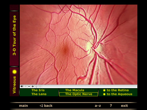 iris retina